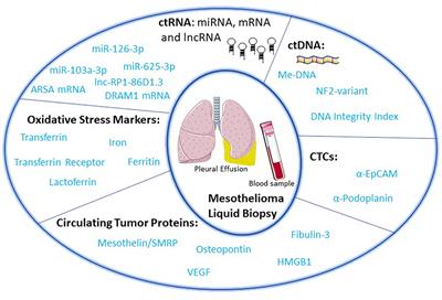 Liquid Biopsy in Malignant Pleural Mesothelioma: State of the Art, Pitfalls, and Perspectives